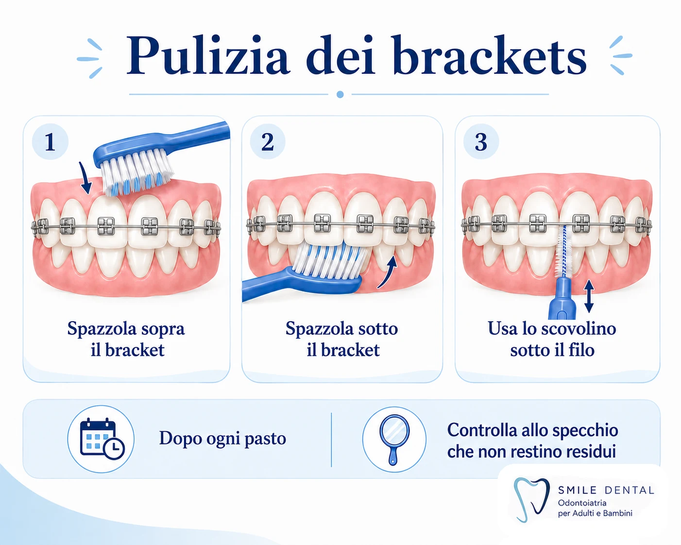 Igiene con apparecchio fisso