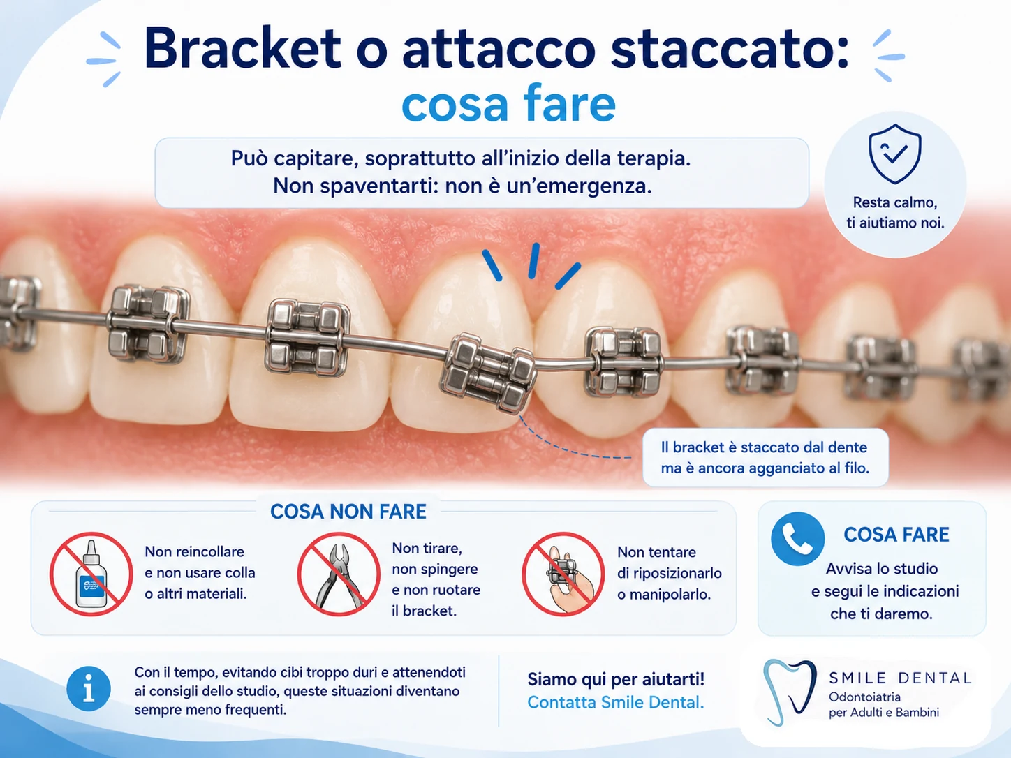 Bracket o attacco staccato