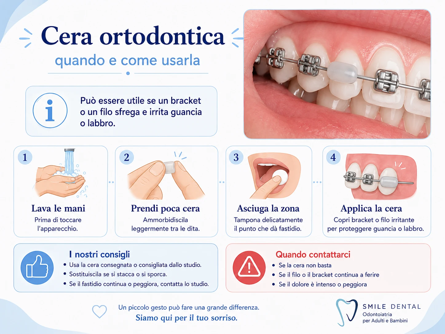 Cera ortodontica