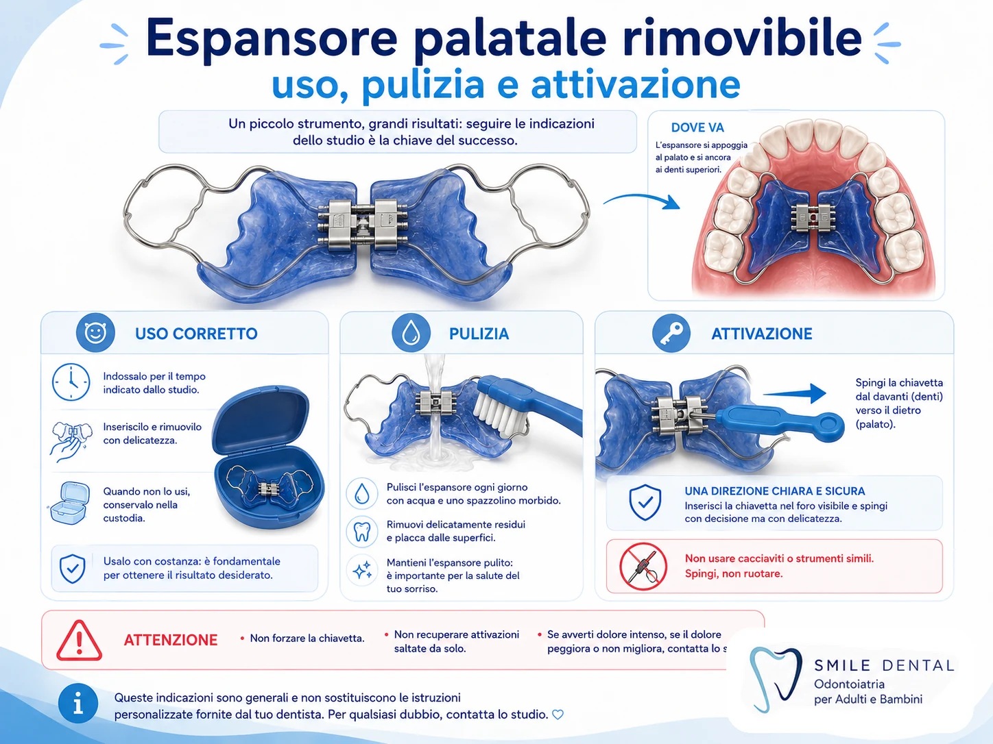 Espansore palatale rimovibile uso pulizia attivazione