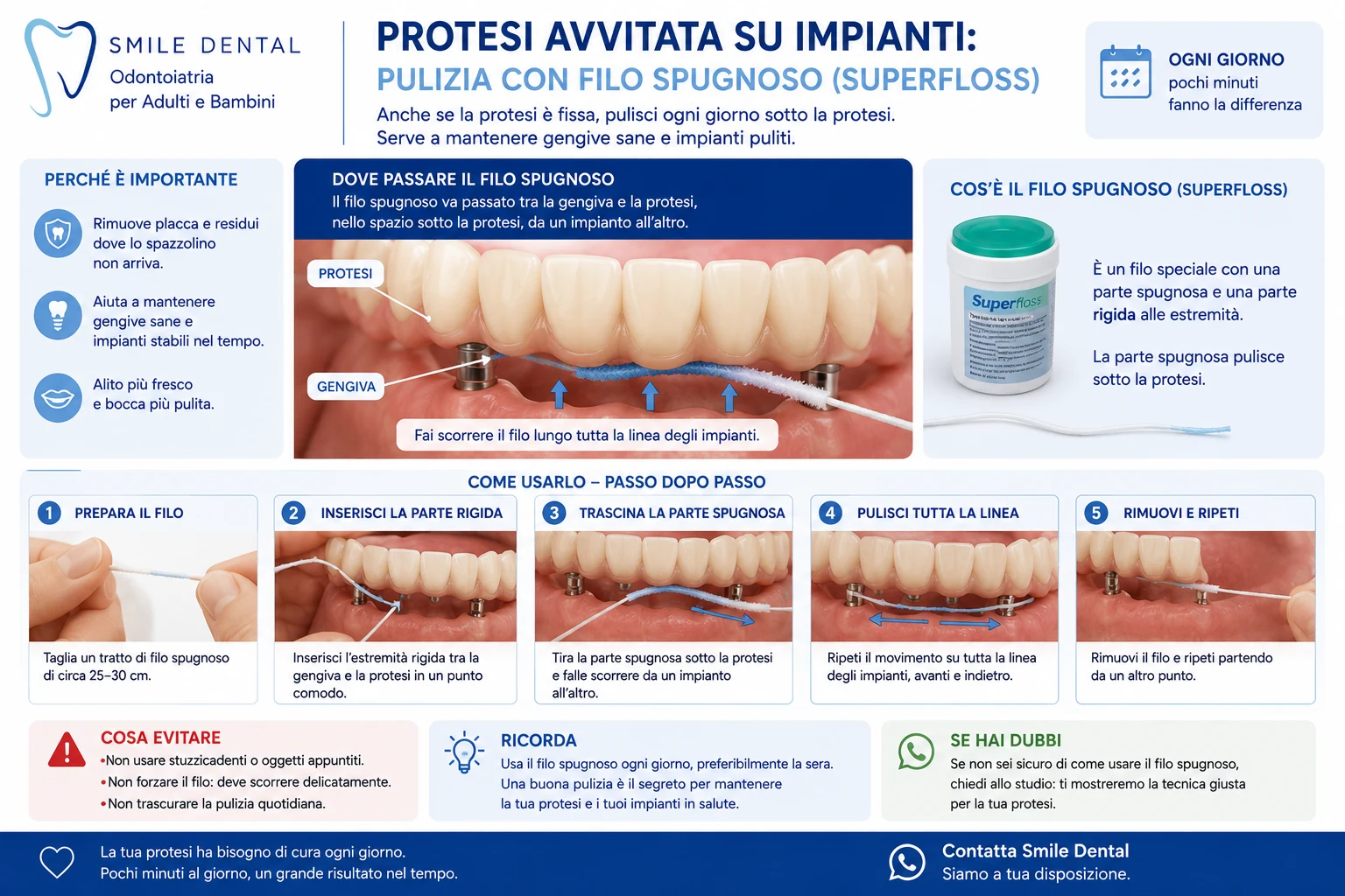 Protesi avvitata su impianti: pulizia con filo spugnoso