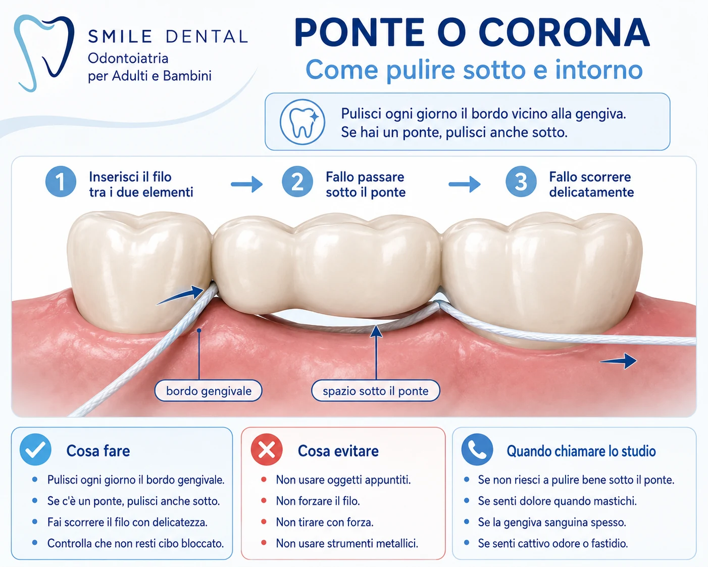 Ponte o corona: pulizia sotto e intorno